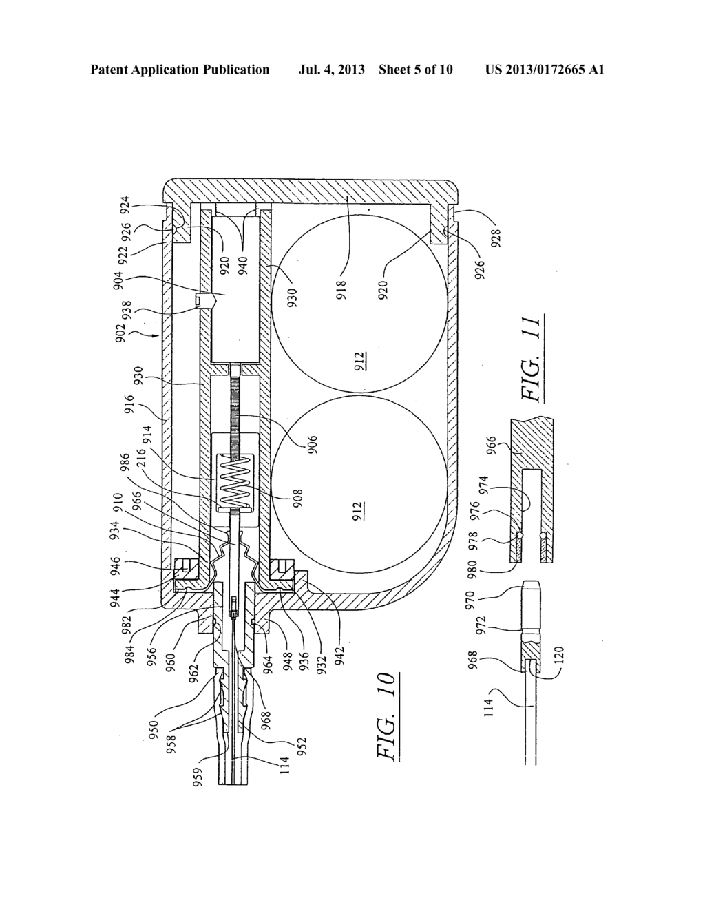 BODY CANAL CONTACTING MEANS FOR BODY FLUID FLOW CONTROL METHODS AND     DEVICES - diagram, schematic, and image 06