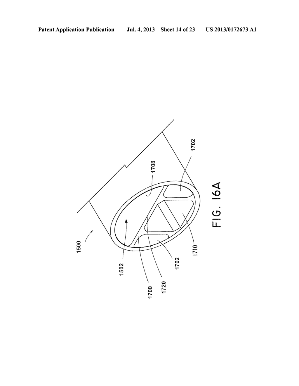 SPACE-OPTIMIZED VISUALIZATION CATHETER - diagram, schematic, and image 15