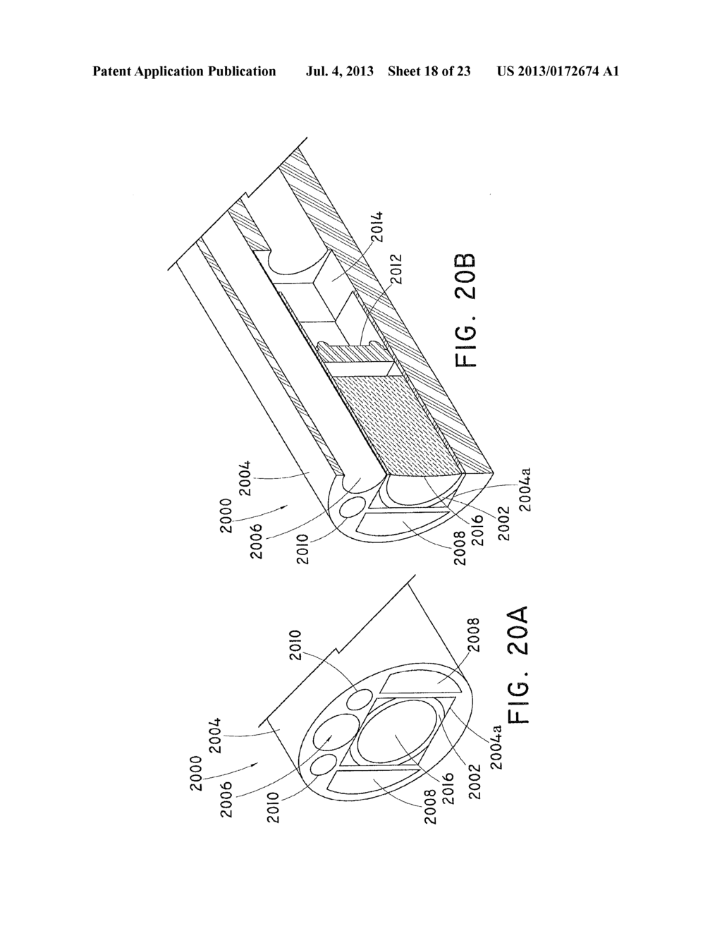 SPACE-OPTIMIZED VISUALIZATION CATHETER WITH CAMERA TRAIN HOLDER IN A     CATHETER WITH OFF-CENTERED LUMENS - diagram, schematic, and image 19