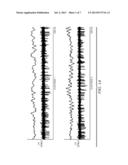 IDENTIFYING AREAS OF THE BRAIN BY EXAMINING THE NEURONAL SIGNALS diagram and image