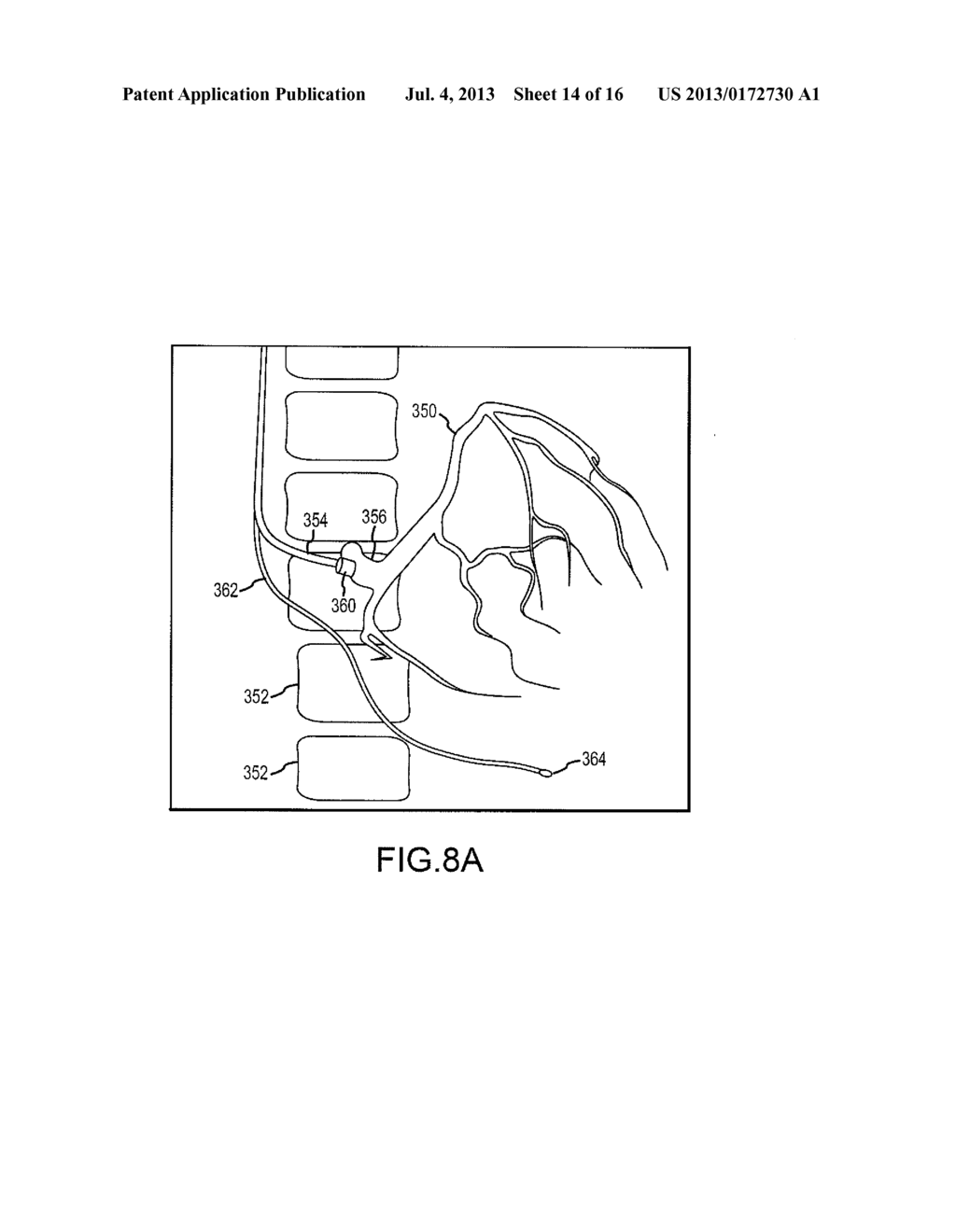 Motion-Compensated Image Fusion - diagram, schematic, and image 15