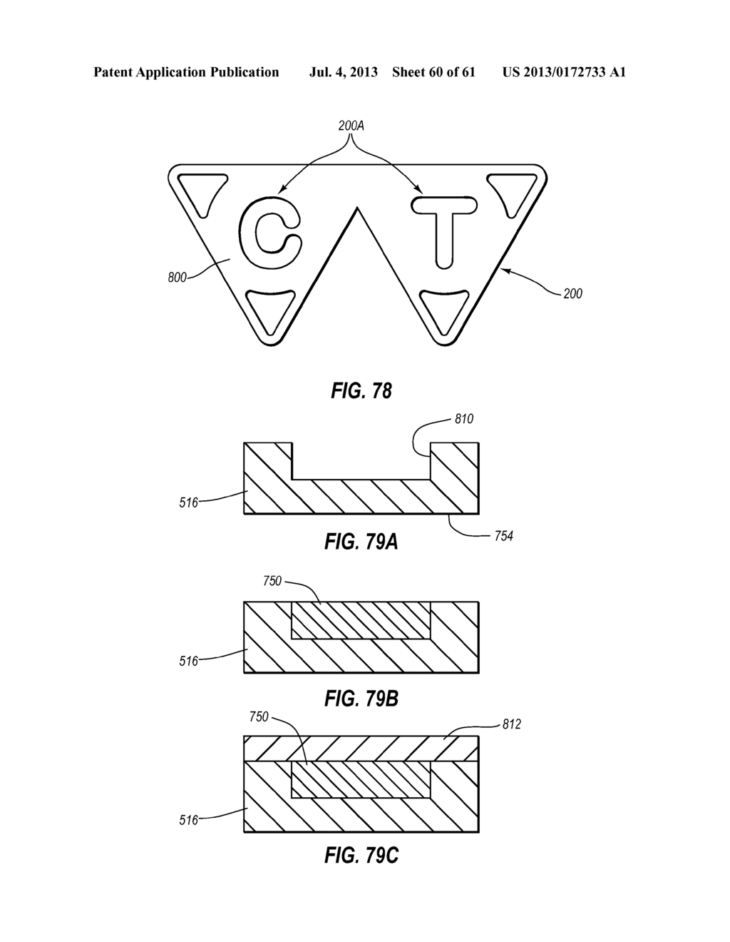 Systems and Methods for Radiographically Identifying an Access Port - diagram, schematic, and image 61