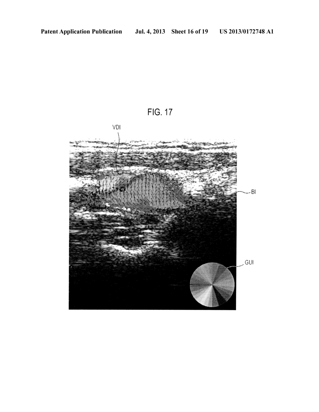 PROVIDING USER INTERFACE IN ULTRASOUND SYSTEM - diagram, schematic, and image 17