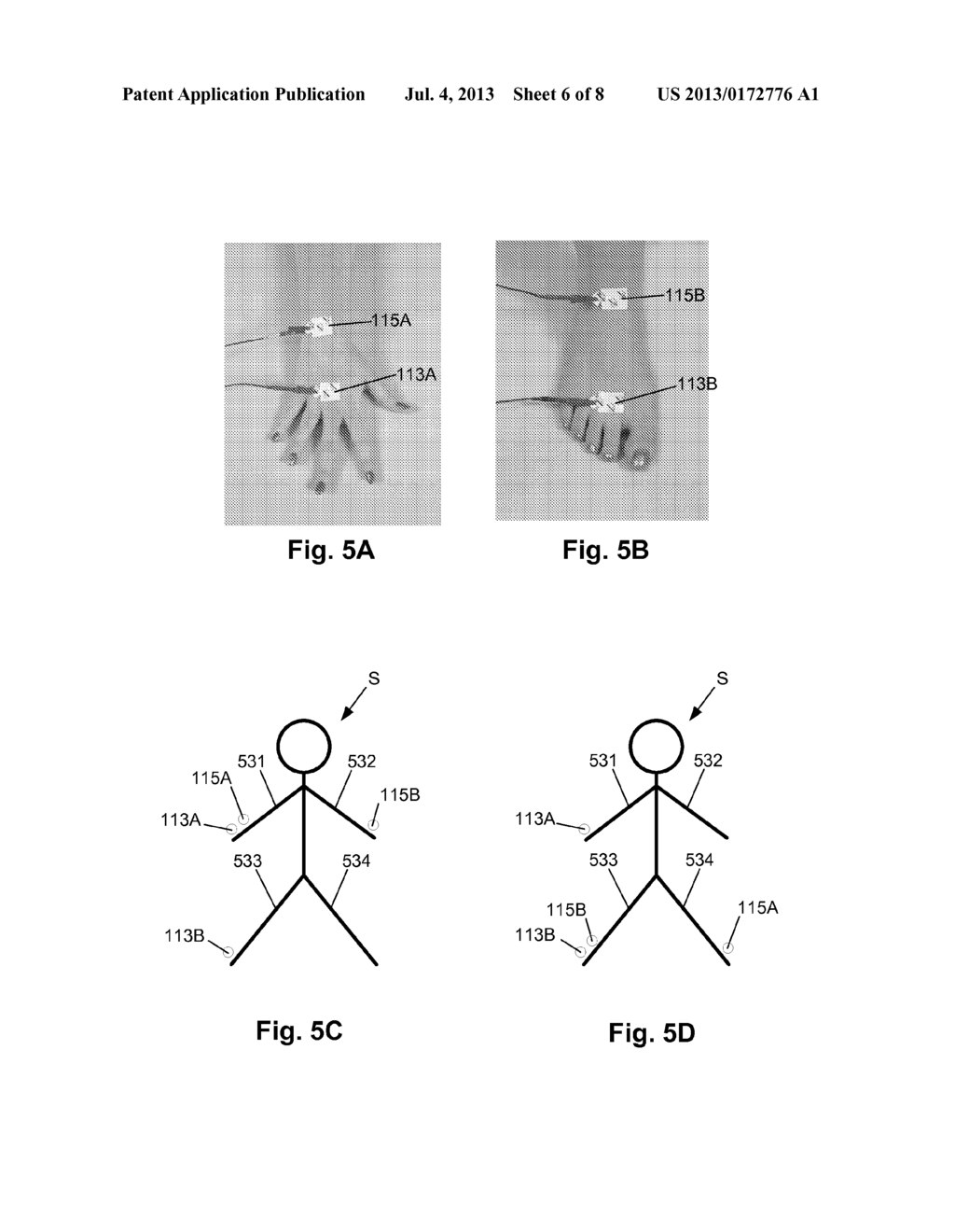 TISSUE INDICATOR DETERMINATION - diagram, schematic, and image 07