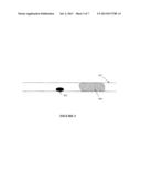 Confinement of Kidney Stone Fragments During Lithotripsy diagram and image