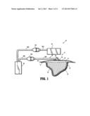 System for Providing Continual Drainage in Negative Pressure Would Therapy diagram and image