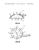 System for Providing Continual Drainage in Negative Pressure Would Therapy diagram and image