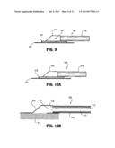 System for Providing Continual Drainage in Negative Pressure Would Therapy diagram and image