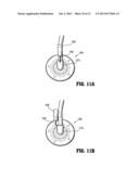 System for Providing Continual Drainage in Negative Pressure Would Therapy diagram and image