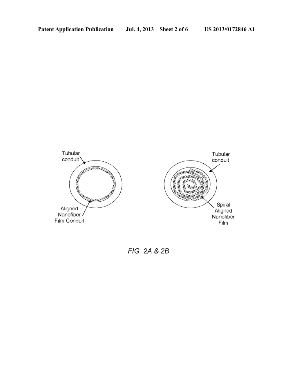 DEVICES, SYSTEMS, AND METHODS FOR EXCAVATING CANCER CELLS - diagram, schematic, and image 03