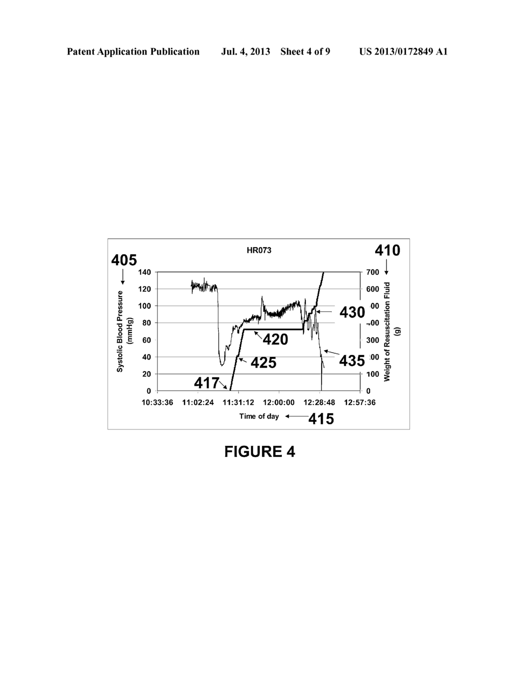 System and Method for Providing Servo-Controlled Resuscitation - diagram, schematic, and image 05