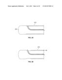 ENDOLUMINAL DELIVERY OF ANESTHESIA diagram and image