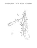 FIXATION SYSTEM, AN INTRAMEDULLARY FIXATION ASSEMBLY AND METHOD OF USE diagram and image