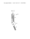 FIXATION SYSTEM, AN INTRAMEDULLARY FIXATION ASSEMBLY AND METHOD OF USE diagram and image