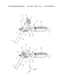 Suprapatellar Insertion System, Kit and Method diagram and image