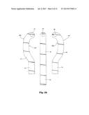 EXPANDABLE SHIELD INSTRUMENT FOR USE IN INTRAOCULAR SURGERY diagram and image