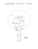 EXPANDABLE SHIELD INSTRUMENT FOR USE IN INTRAOCULAR SURGERY diagram and image