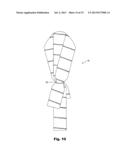 EXPANDABLE SHIELD INSTRUMENT FOR USE IN INTRAOCULAR SURGERY diagram and image