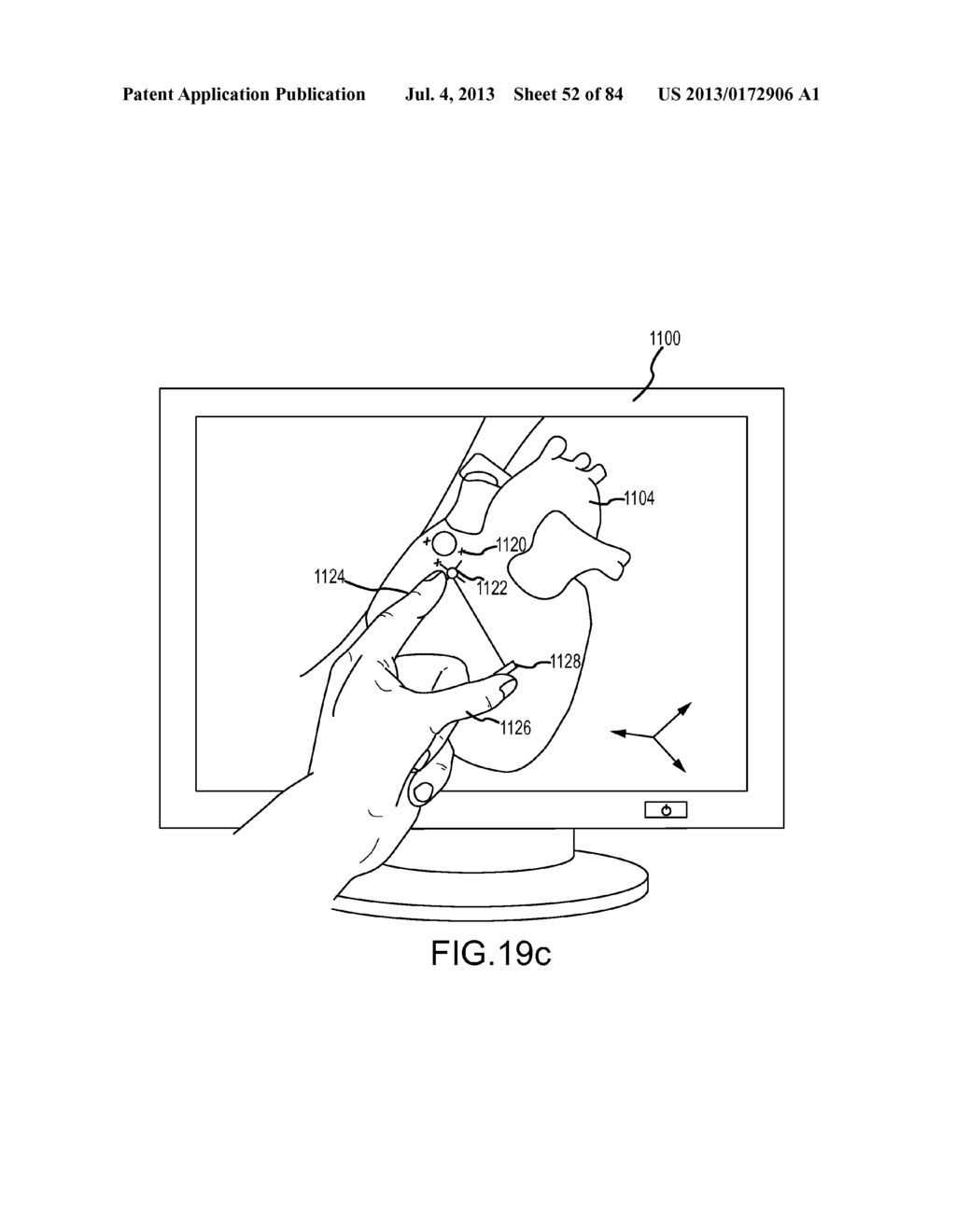 Intuitive user interface control for remote catheter navigation and 3D     mapping and visualization systems - diagram, schematic, and image 53