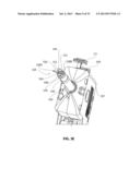 ANATOMICAL LOCATION MARKERS AND METHODS OF USE IN POSITIONING SHEET-LIKE     MATERIALS DURING SURGERY diagram and image