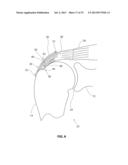 ANATOMICAL LOCATION MARKERS AND METHODS OF USE IN POSITIONING SHEET-LIKE     MATERIALS DURING SURGERY diagram and image