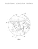 ANATOMICAL LOCATION MARKERS AND METHODS OF USE IN POSITIONING SHEET-LIKE     MATERIALS DURING SURGERY diagram and image