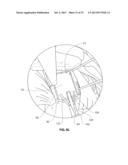 ANATOMICAL LOCATION MARKERS AND METHODS OF USE IN POSITIONING SHEET-LIKE     MATERIALS DURING SURGERY diagram and image