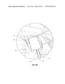 ANATOMICAL LOCATION MARKERS AND METHODS OF USE IN POSITIONING SHEET-LIKE     MATERIALS DURING SURGERY diagram and image