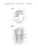 BONE ANCHORING DEVICE diagram and image