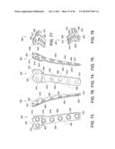 SYSTEMS AND METHODS FOR USING POLYAXIAL PLATES diagram and image