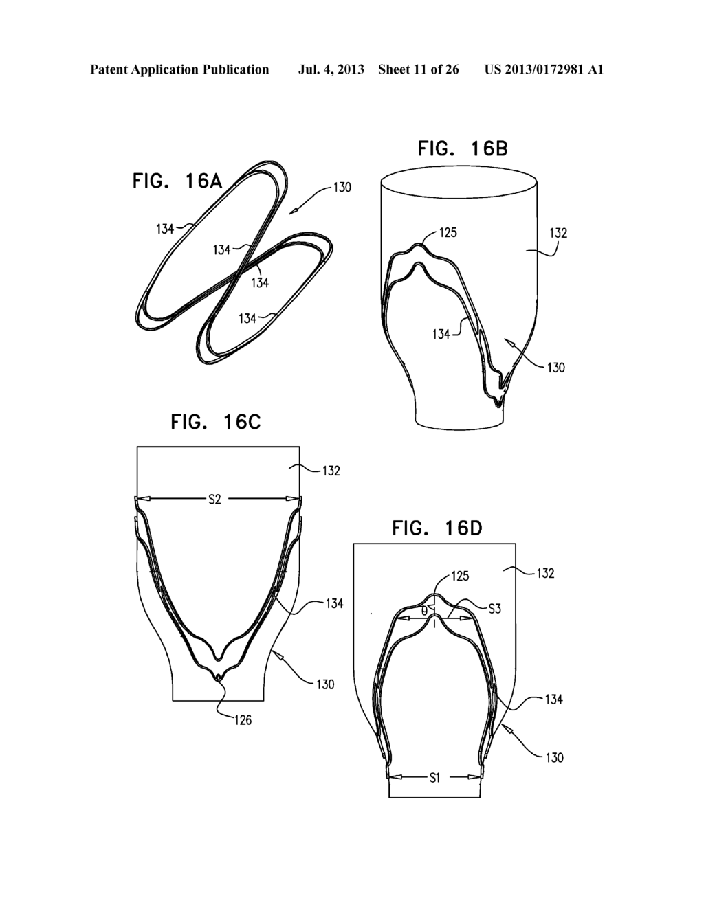 DEVICES AND METHODS FOR CONTROL OF BLOOD PRESSURE - diagram, schematic, and image 12