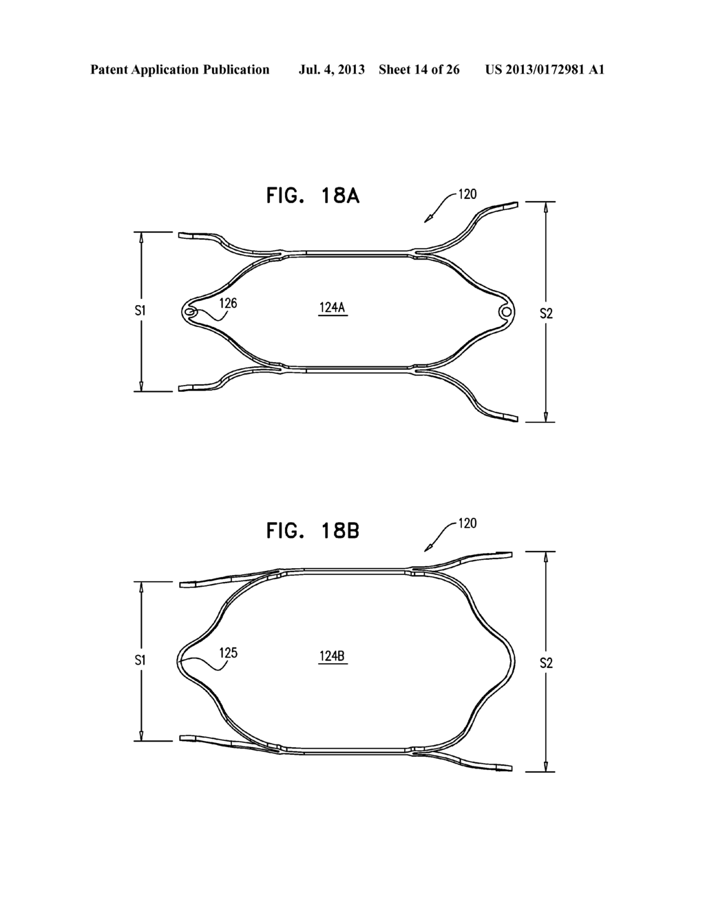 DEVICES AND METHODS FOR CONTROL OF BLOOD PRESSURE - diagram, schematic, and image 15