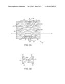 POLYMER STENT WITH BREAK-AWAY LINKS FOR ENHANCED STENT RETENTION diagram and image