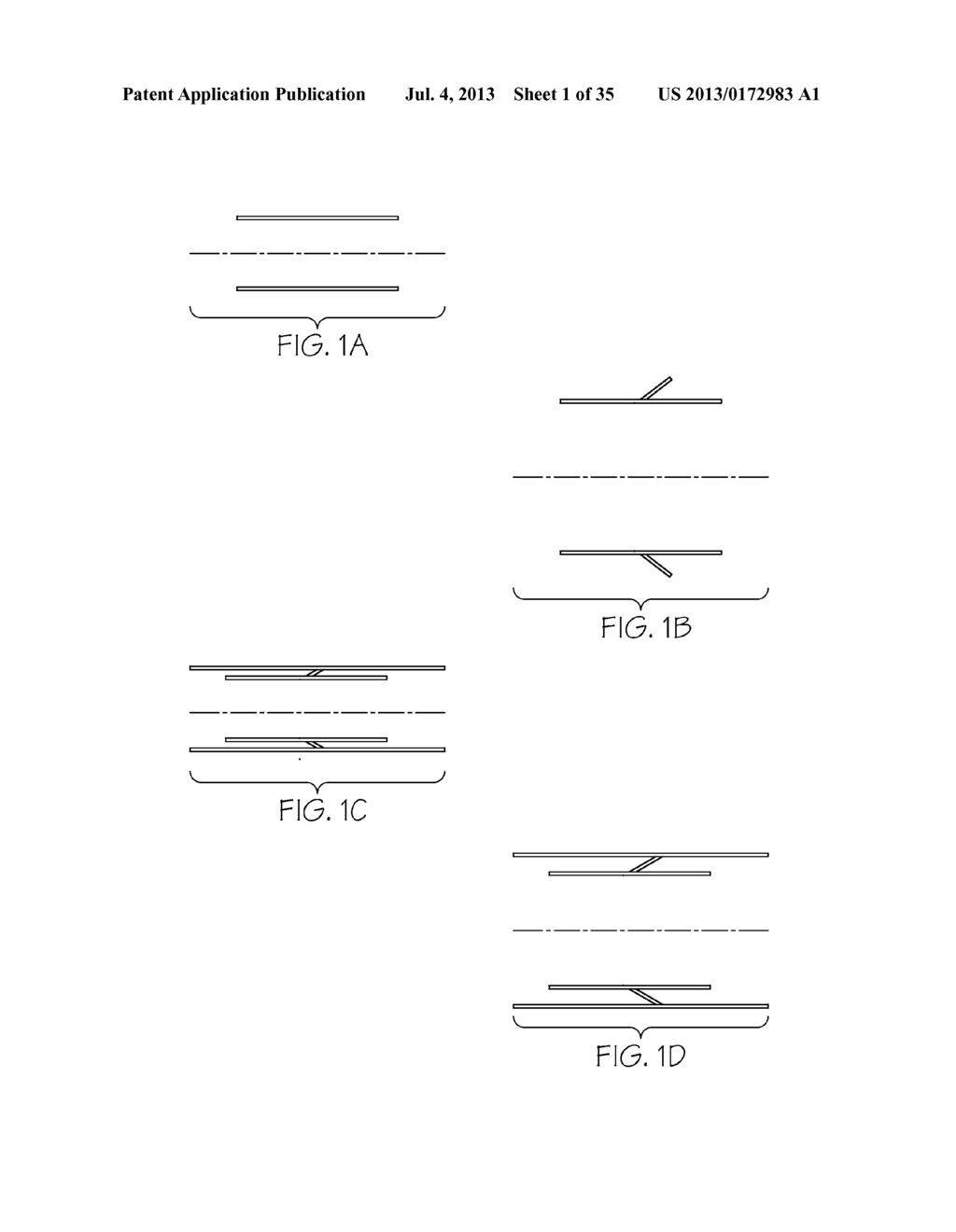 Stent with Anti-Migration Features - diagram, schematic, and image 02