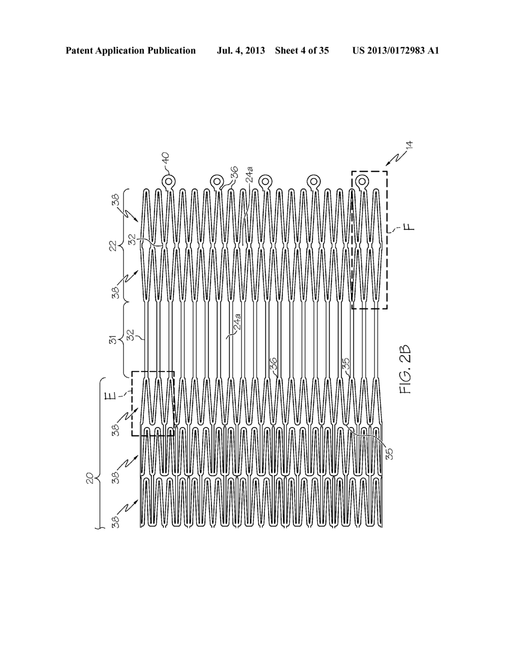 Stent with Anti-Migration Features - diagram, schematic, and image 05