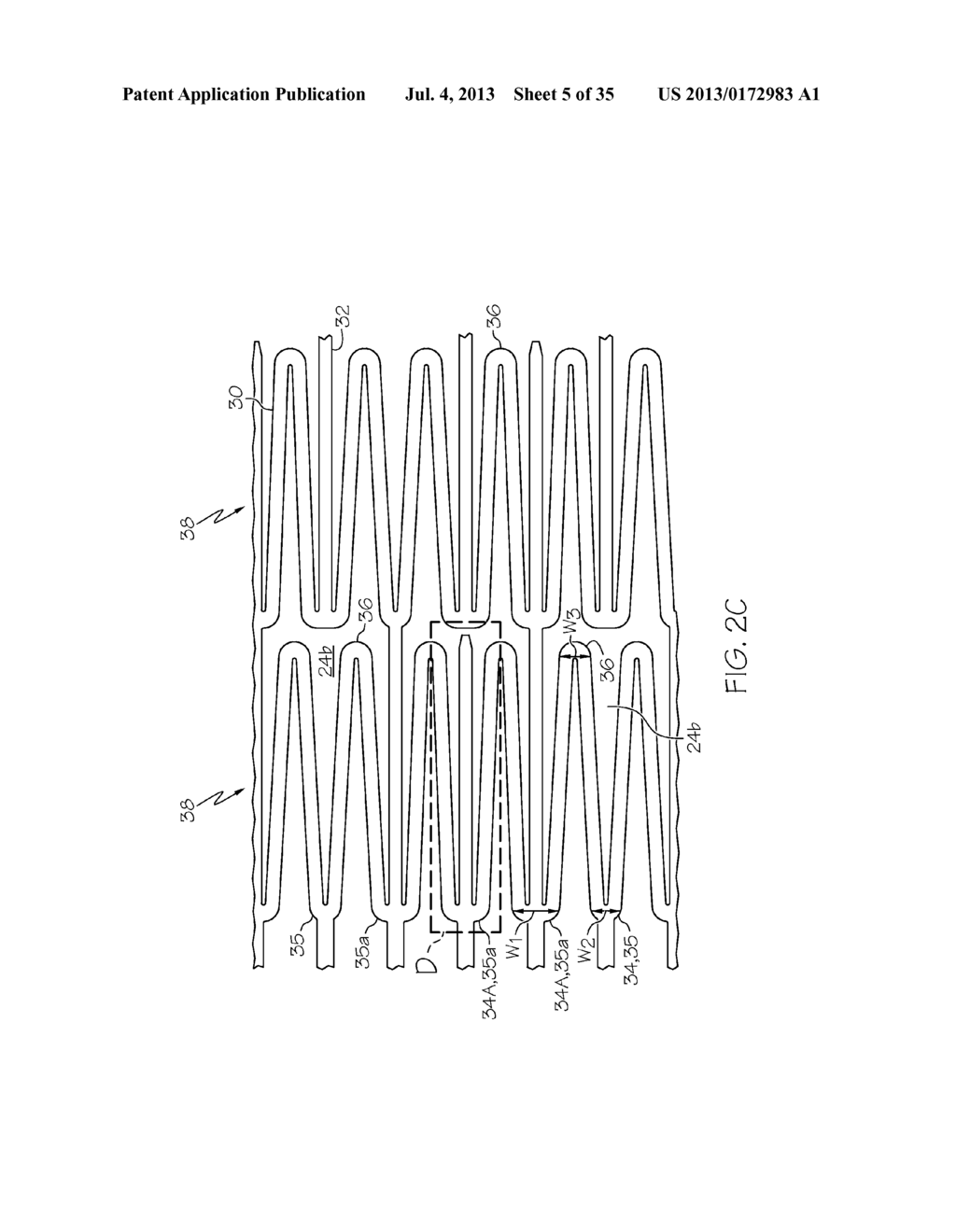 Stent with Anti-Migration Features - diagram, schematic, and image 06