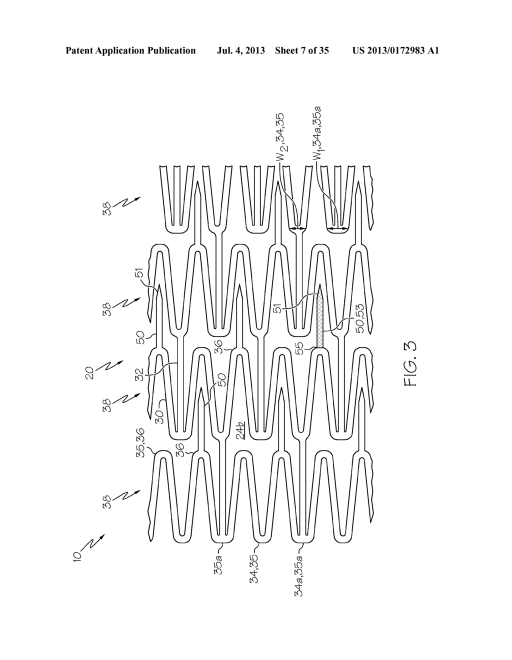 Stent with Anti-Migration Features - diagram, schematic, and image 08