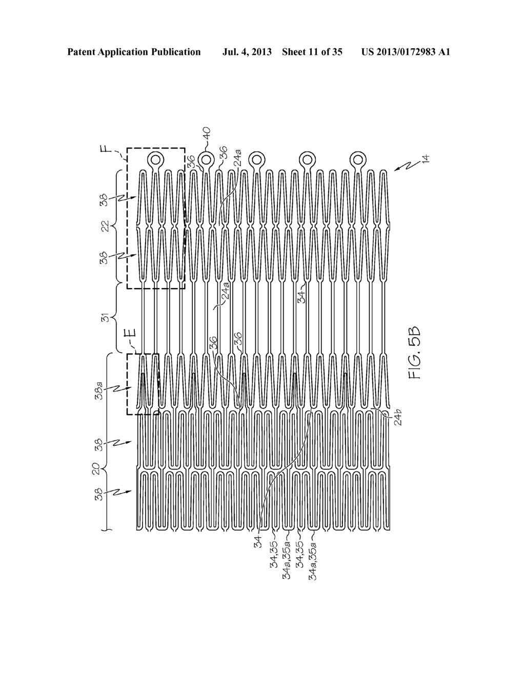 Stent with Anti-Migration Features - diagram, schematic, and image 12