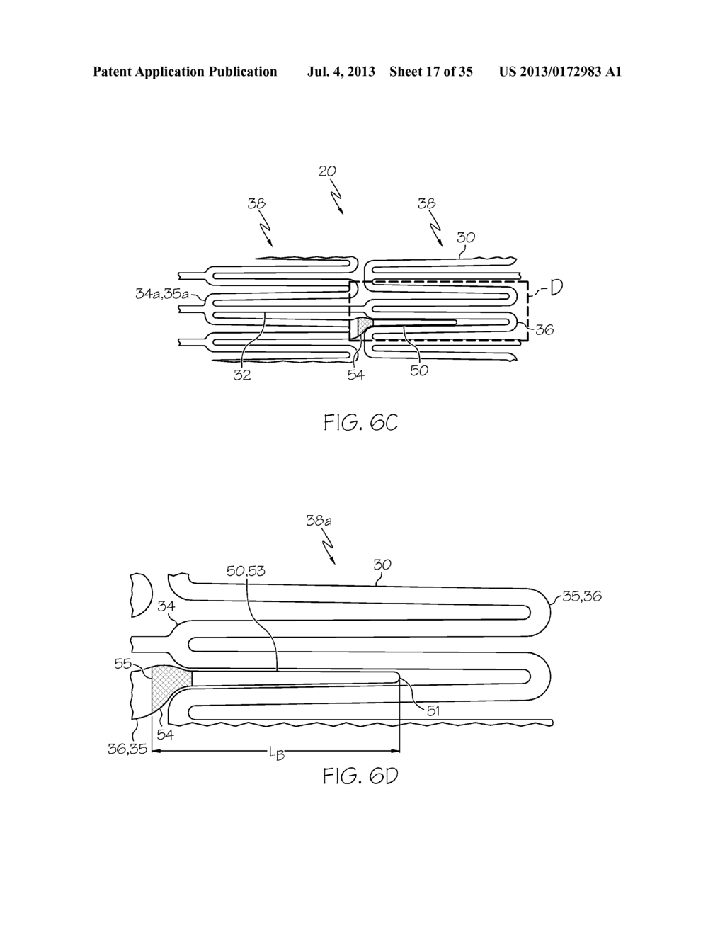 Stent with Anti-Migration Features - diagram, schematic, and image 18