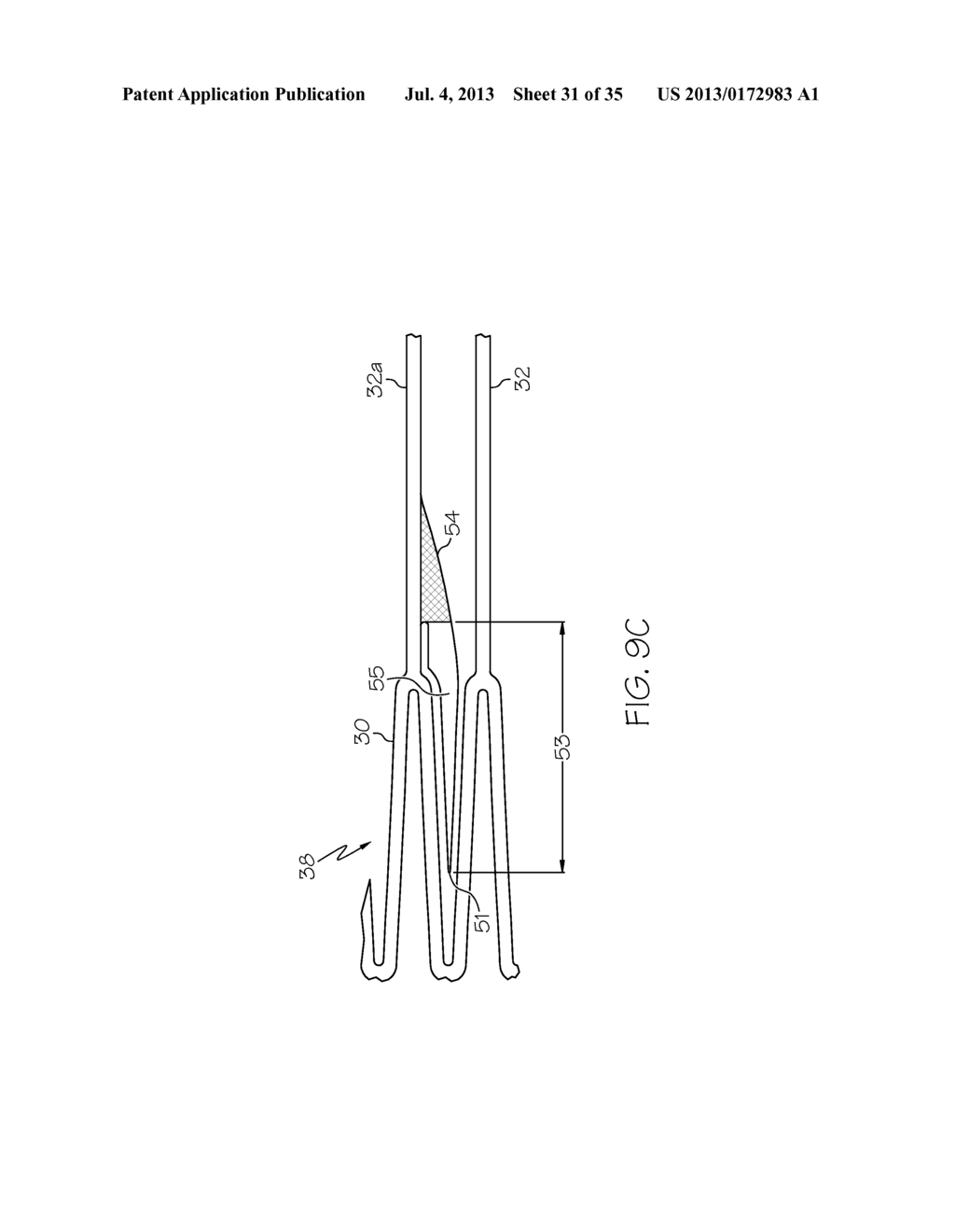 Stent with Anti-Migration Features - diagram, schematic, and image 32