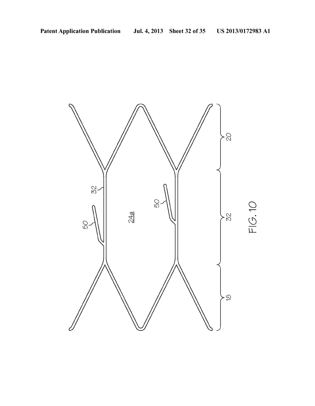 Stent with Anti-Migration Features - diagram, schematic, and image 33