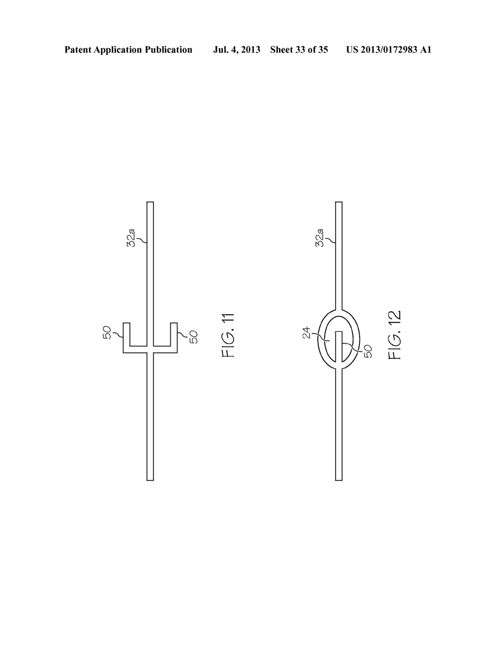 Stent with Anti-Migration Features - diagram, schematic, and image 34