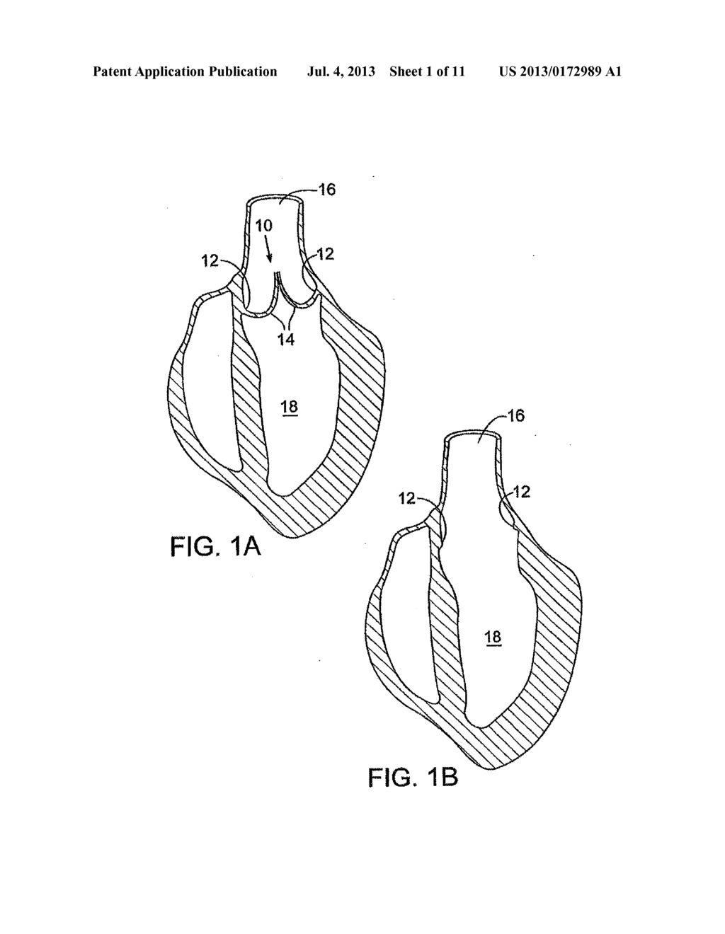 METHODS FOR MEASURING BODY ORIFICE - diagram, schematic, and image 02