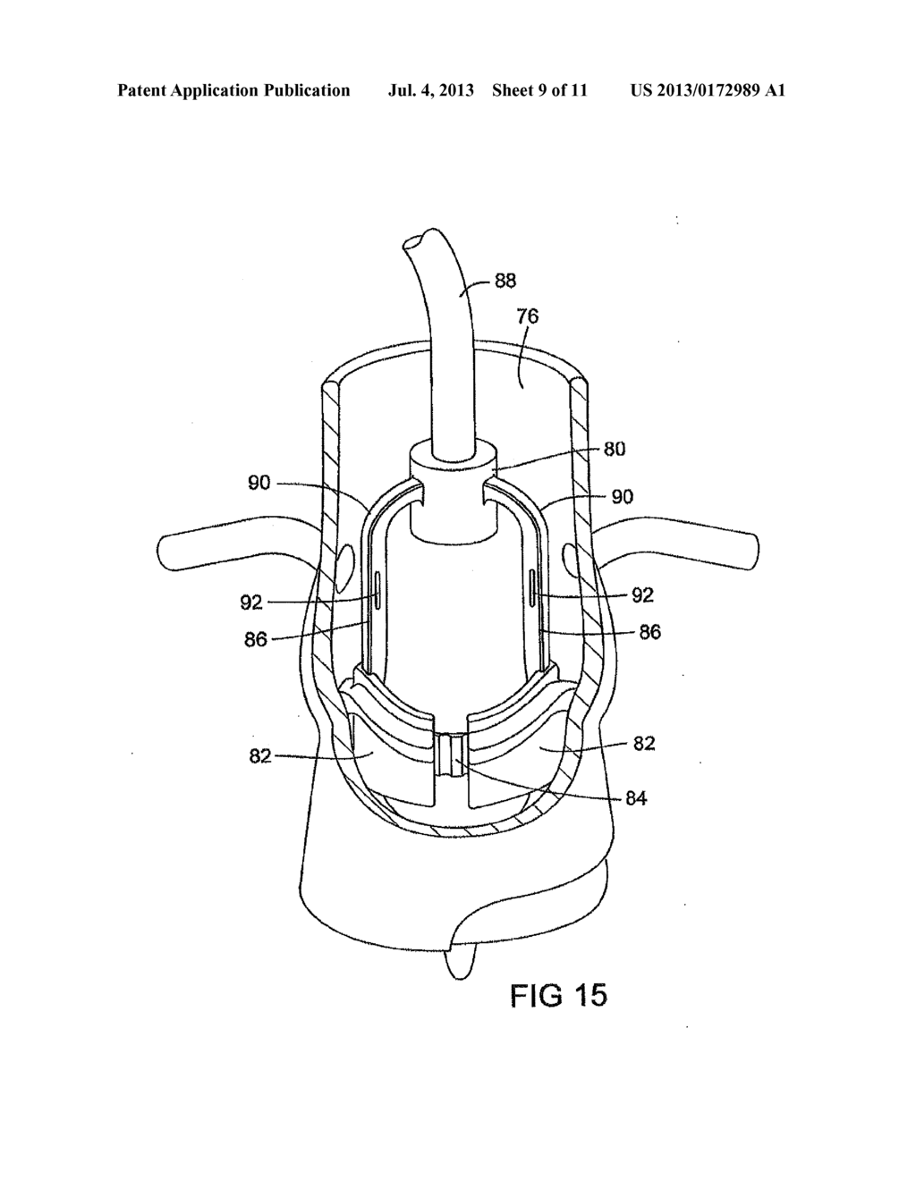 METHODS FOR MEASURING BODY ORIFICE - diagram, schematic, and image 10