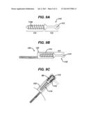 METHODS FOR LIGAMENT RECONSTRUCTION diagram and image