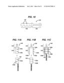 METHODS FOR LIGAMENT RECONSTRUCTION diagram and image