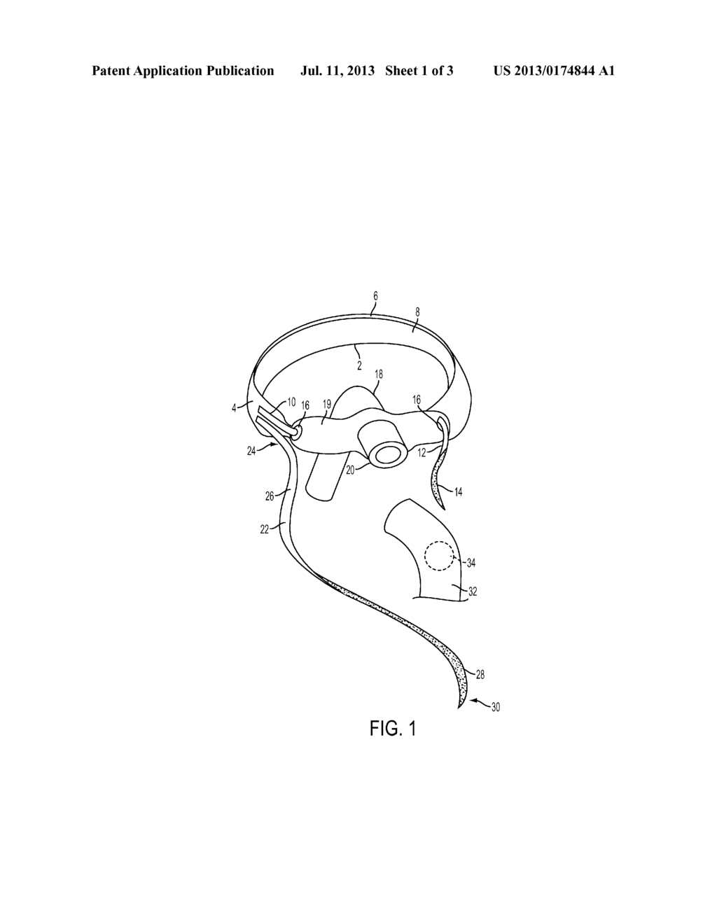 SUPPORT FOR TRACHEOSTOMY OR ENDOTRACHEAL TUBES - diagram, schematic, and image 02