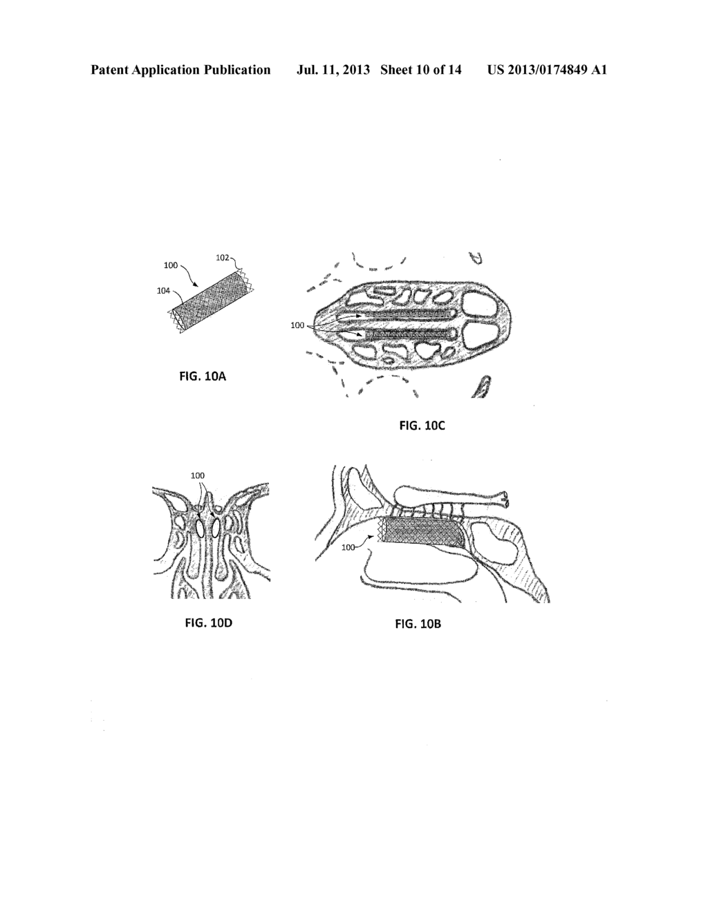 OLFACTORY MODIFYING DEVICES AND RELATED METHODS - diagram, schematic, and image 11