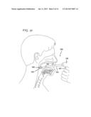 METHODS AND DEVICES FOR TREATMENT OF OBSTRUCTIVE SLEEP APNEA diagram and image