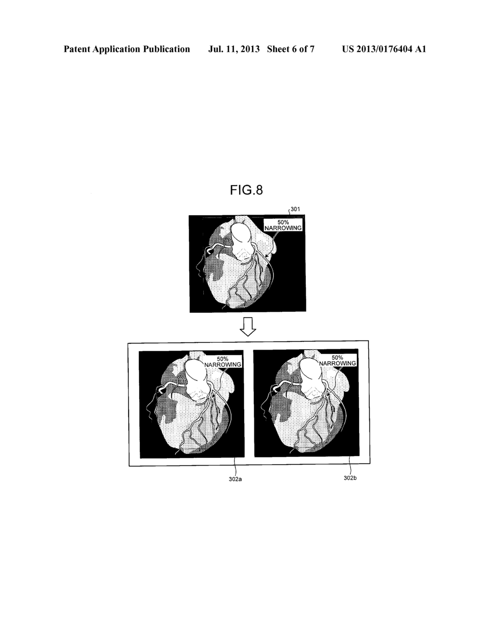 IMAGE PROCESSING APPARATUS, IMAGE PROCESSING METHOD, AND MEDICAL IMAGE     DIAGNOSIS APPARATUS - diagram, schematic, and image 07